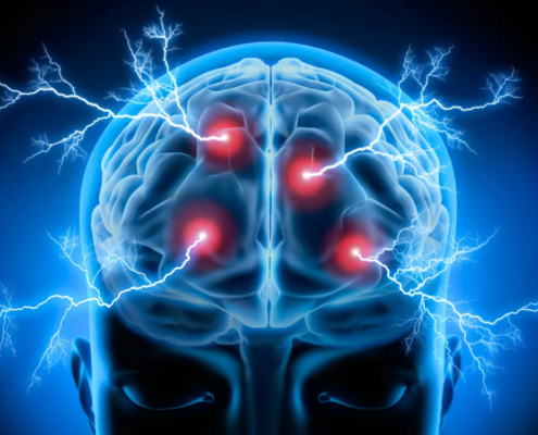 dolore neuropatico da stress sintomi fisici