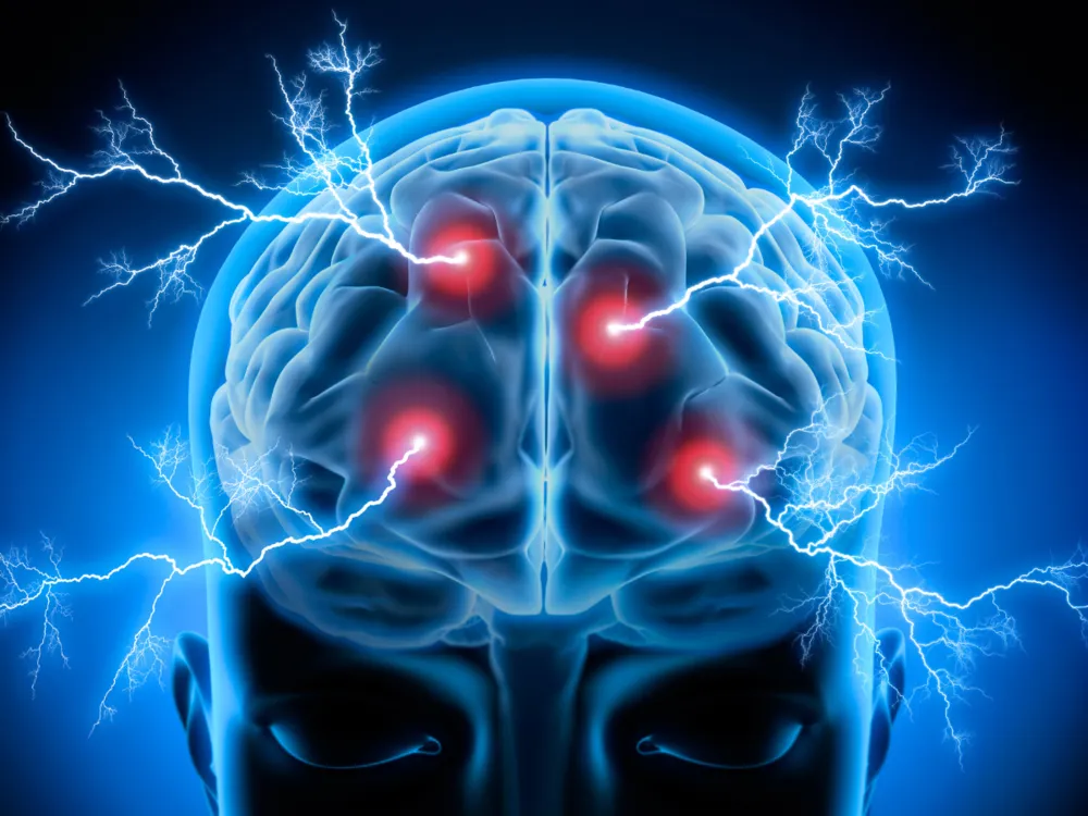 dolore neuropatico da stress sintomi fisici